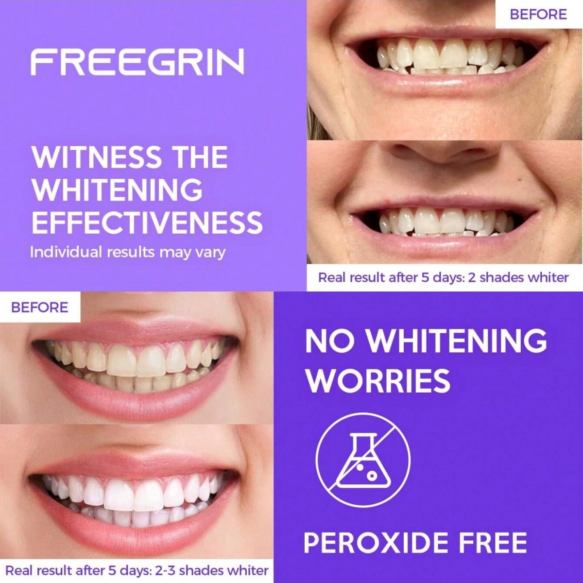 Deluxe Whitening Teeth Sticker - огляд і ціна Home Fragrance Gel